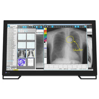 Monitor medicale da consultazione EIZO MS236WT-A