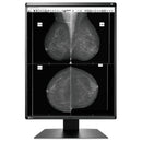 Monitor medicale da refertazione EIZO GX560 + RadiLight Omaggio!