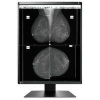 Monitor medicale da refertazione EIZO GX560 + RadiLight Omaggio!