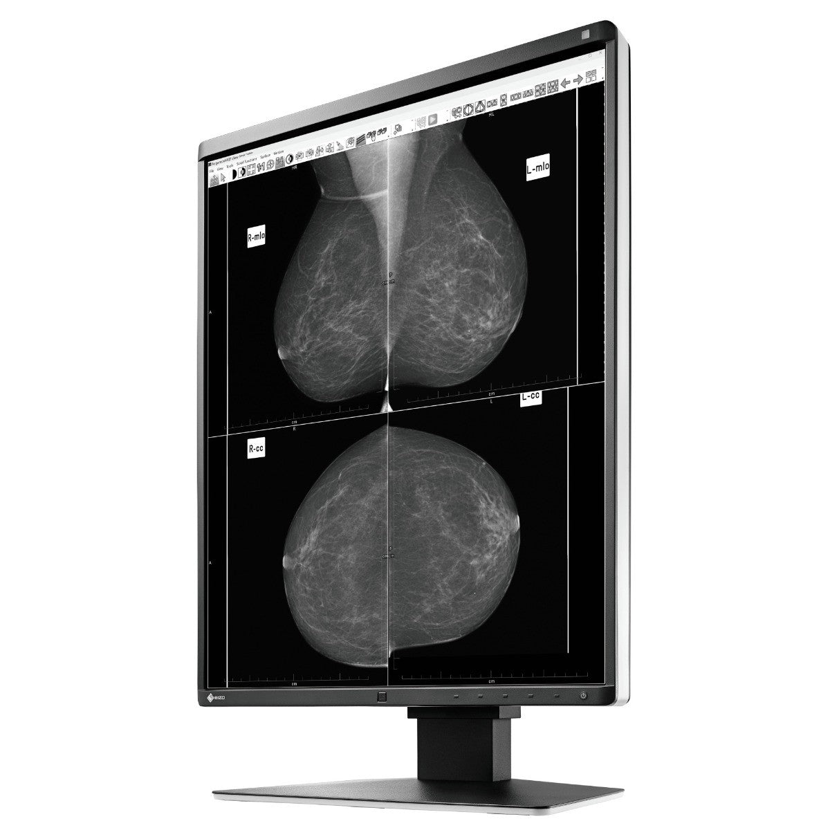 Monitor medicale da refertazione EIZO GX560 + RadiLight Omaggio!