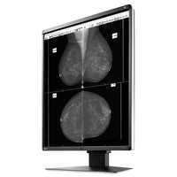 Monitor medicale da refertazione EIZO GX560 + RadiLight Omaggio!
