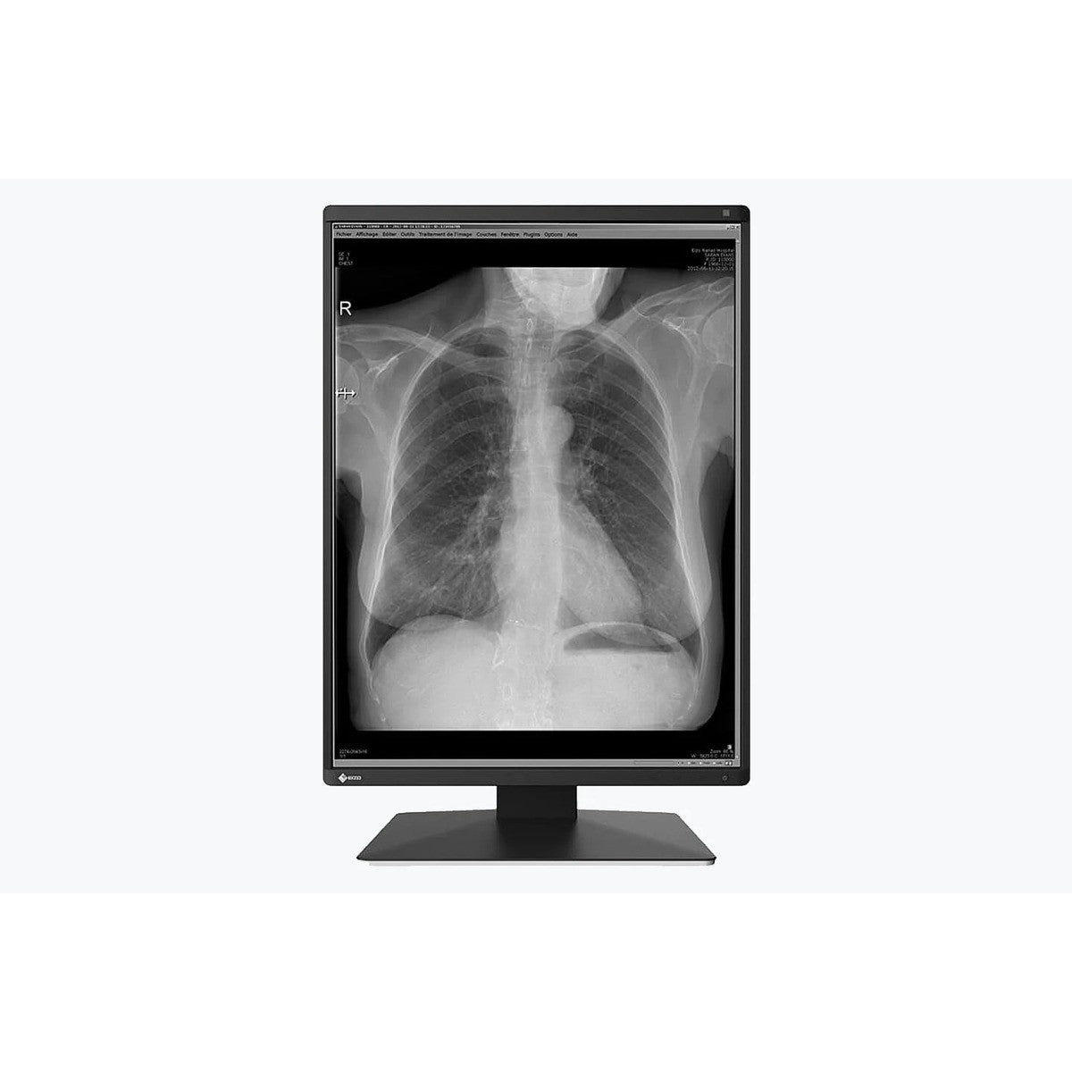 Monitor medicale da consultazione EIZO MS236WT-A