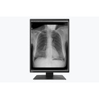 Monitor medicale da consultazione EIZO MS236WT-A