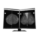 Monitor medicale da refertazione EIZO GX560-MD + RadiLight Omaggio!