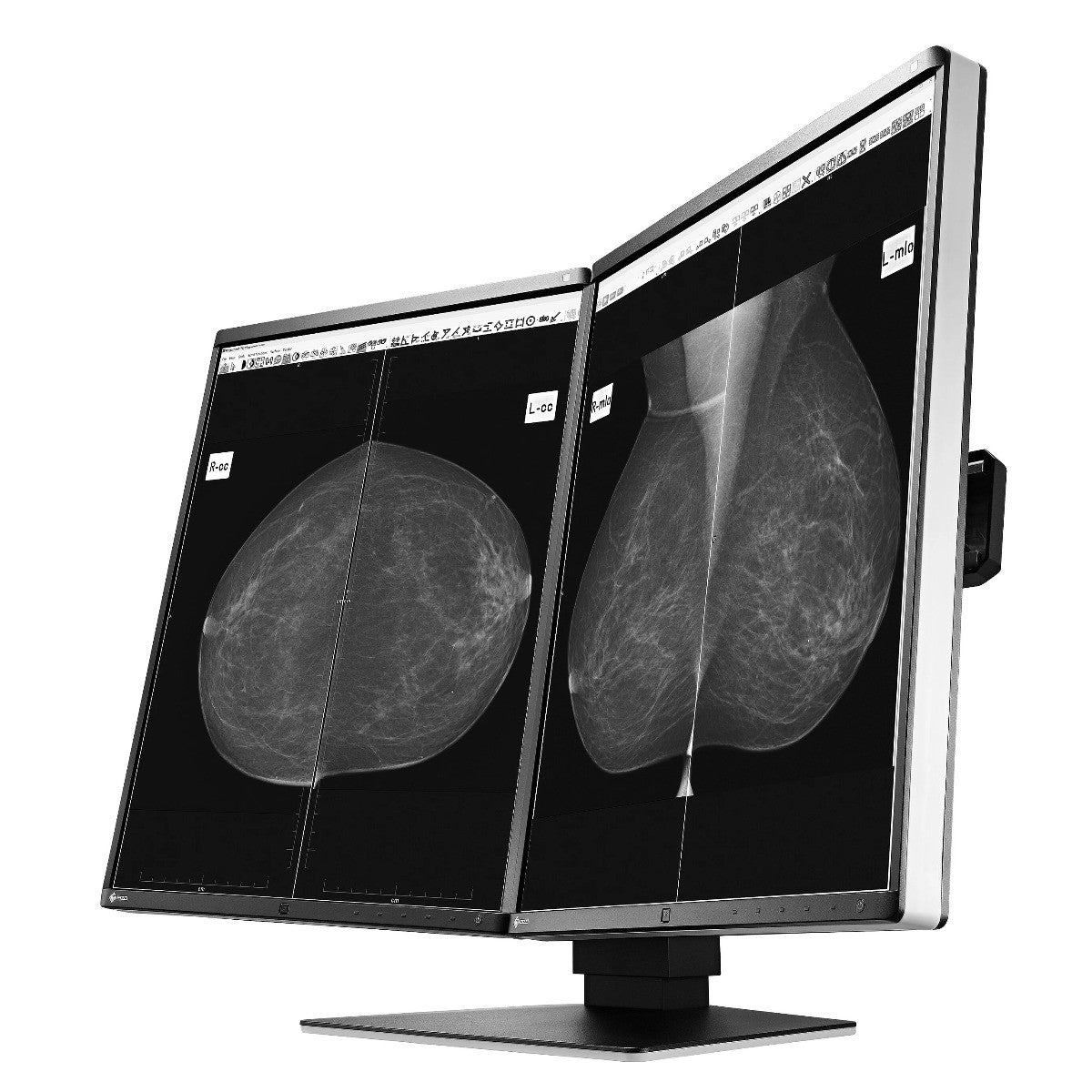 Monitor medicale da refertazione EIZO GX560-MD + RadiLight Omaggio!