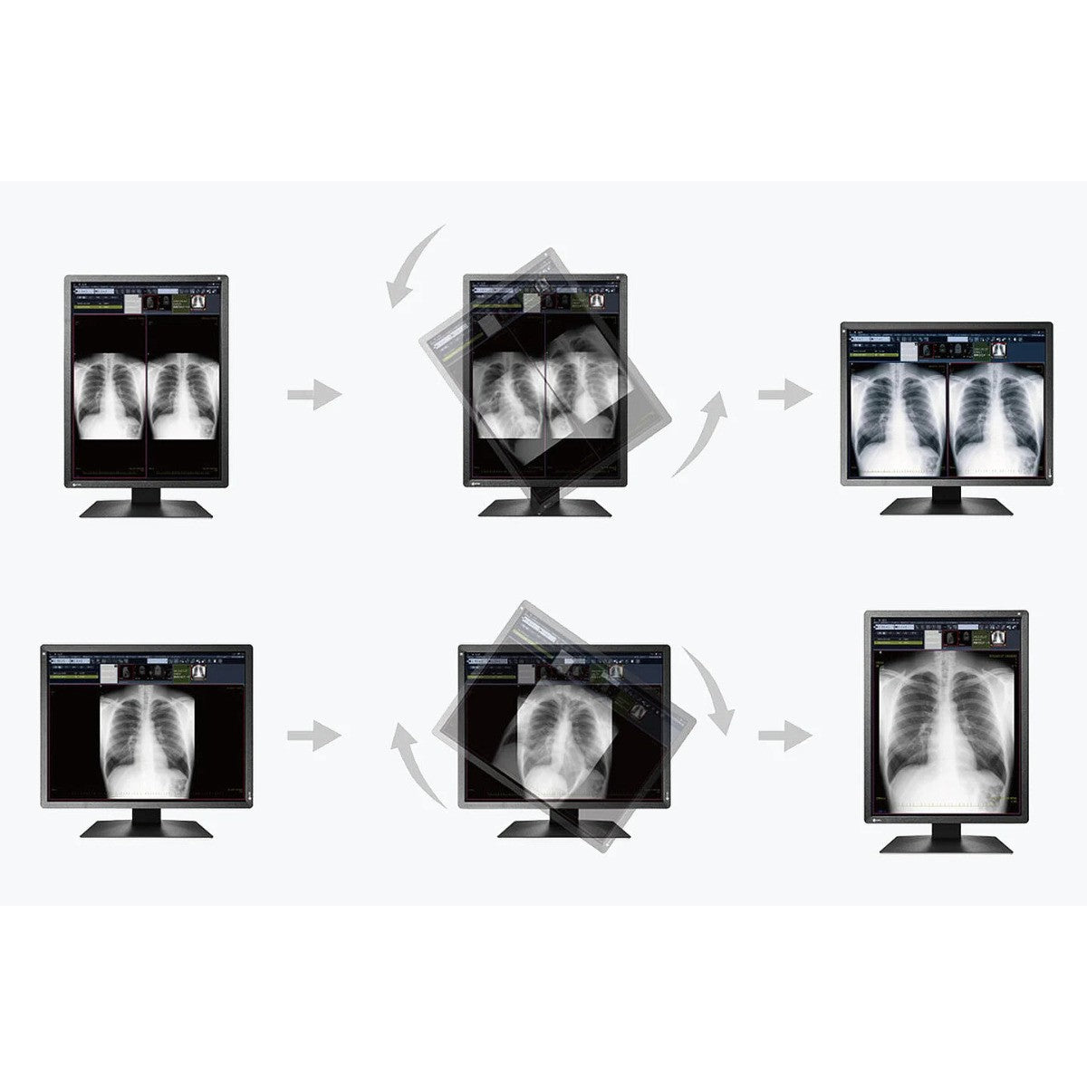 Monitor medicale da consultazione MX217-HB