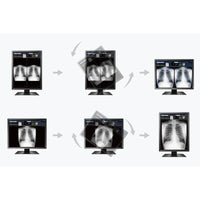 Monitor medicale da consultazione MX217-HB