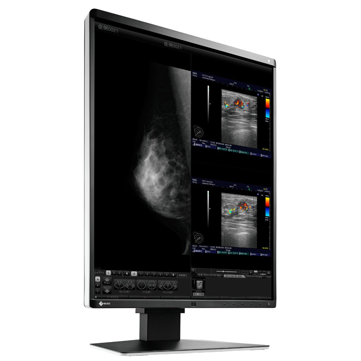 Monitor medicale da refertazione EIZO RX560 + RadiLight Omaggio!