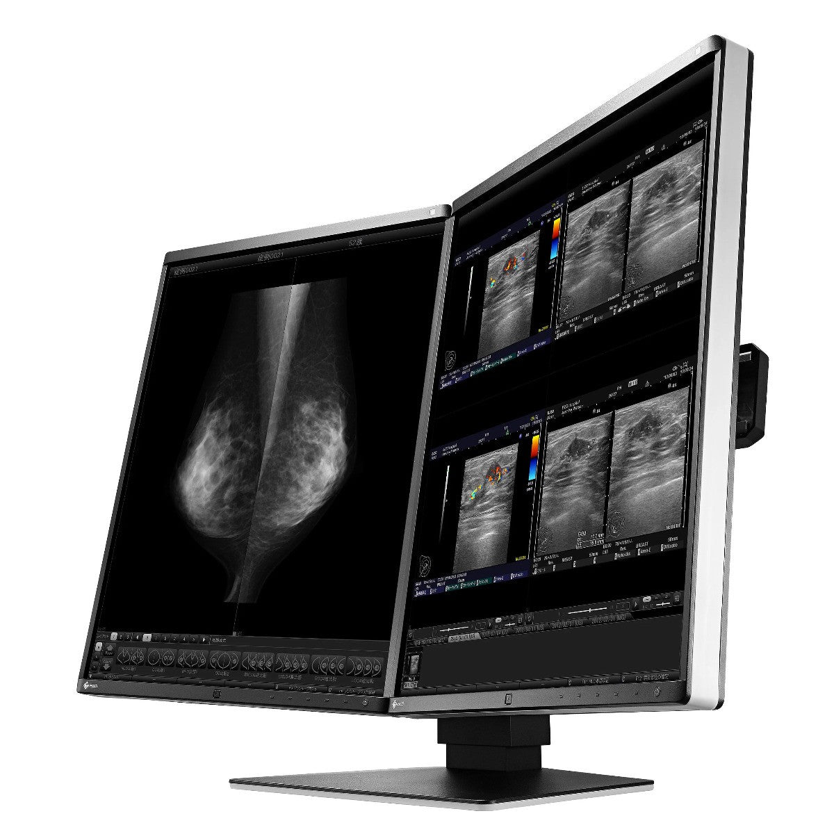 Monitor medicale da refertazione EIZO RX560-MD + RadiLight Omaggio!