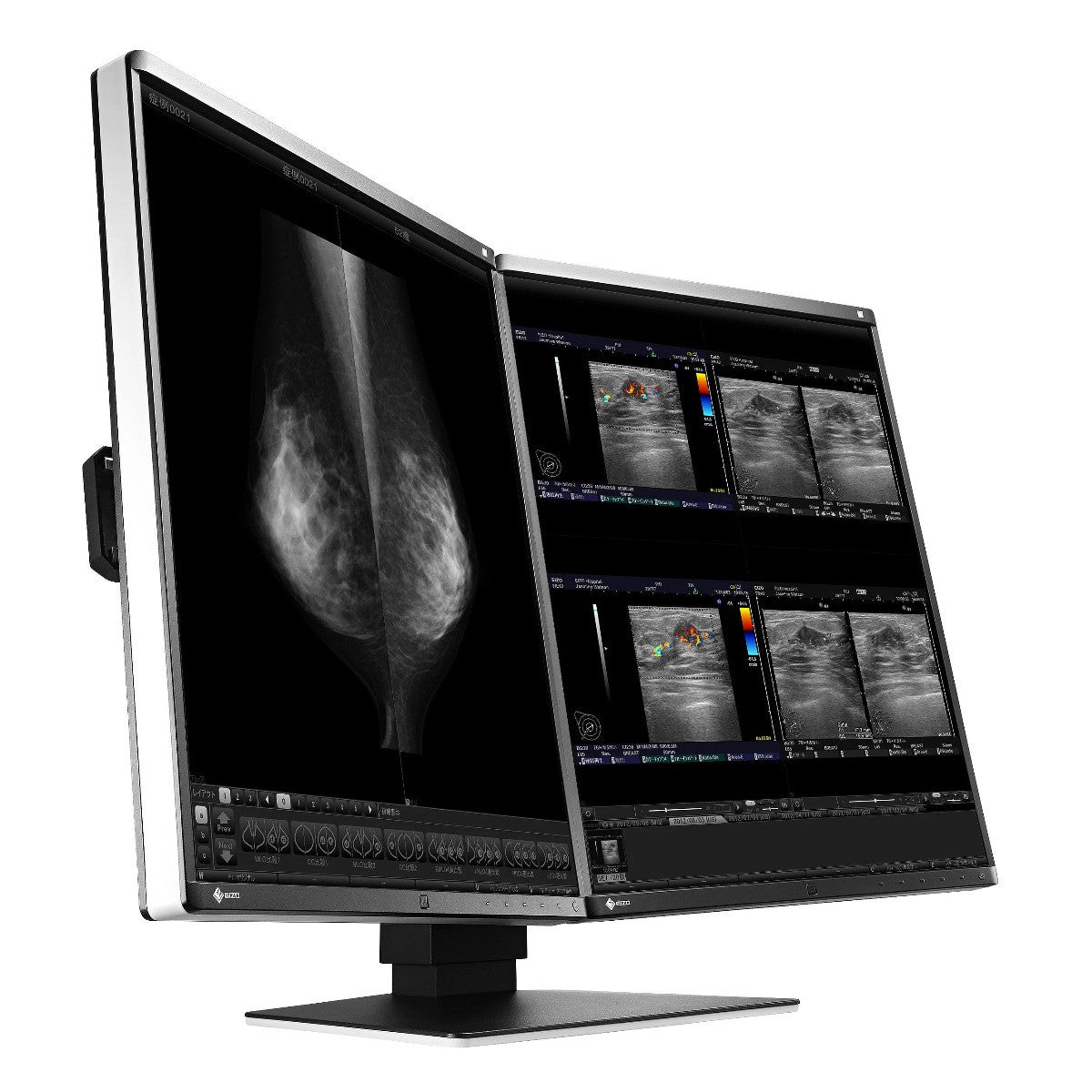 Monitor medicale da refertazione EIZO RX560-MD + RadiLight Omaggio!