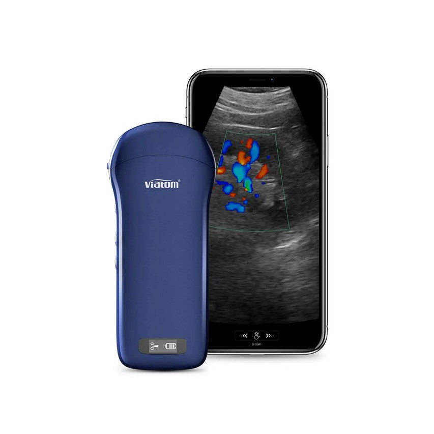 Ecografo Color-Doppler palmare VIATOM 3 in 1 con Sonda Convex, Lineare e Cardio