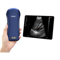 Ecografo Color-Doppler palmare VIATOM 3 in 1 con Sonda Convex, Lineare e Cardio