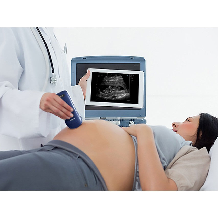 Ecografo Color-Doppler palmare VIATOM 3 in 1 con Sonda Convex, Lineare e Cardio