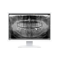 Monitor medicale da consultazione EIZO MX243W-DT
