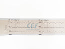 ECG Contec 90A NEW Cardiopocket - Elettrocardiografo a 3 canali + Software PC