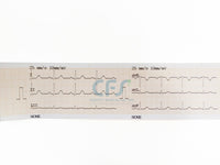 ECG Contec 90A NEW Cardiopocket - Elettrocardiografo a 3 canali + Software PC