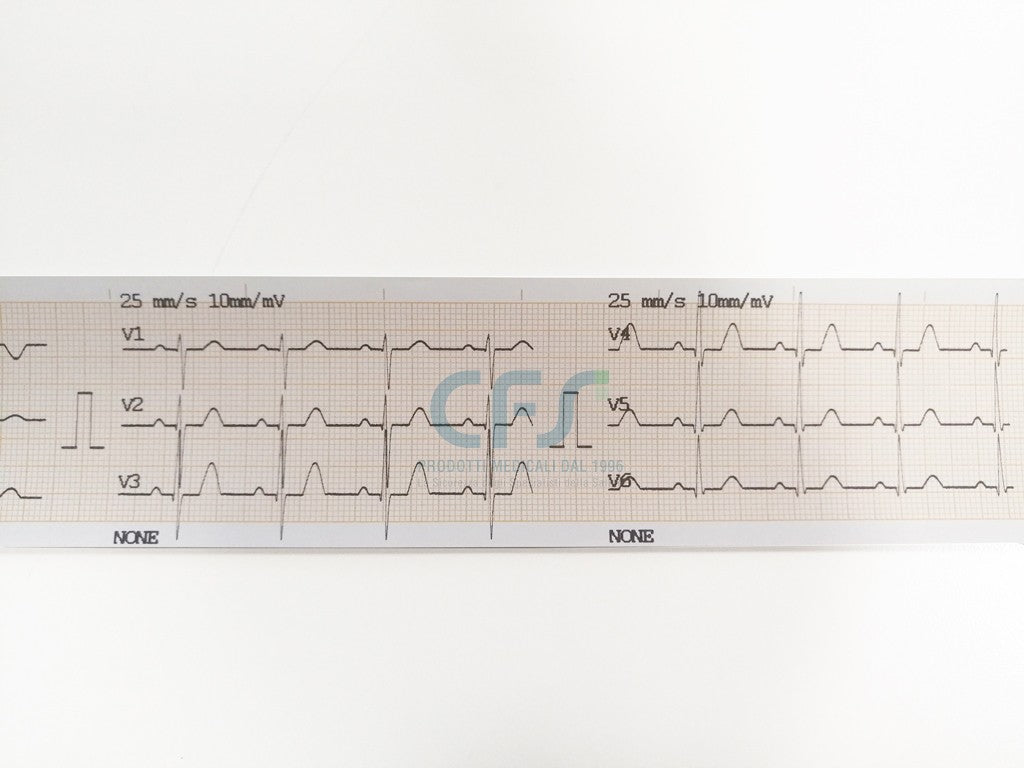 ECG Contec 90A NEW Cardiopocket - Elettrocardiografo a 3 canali + Software PC