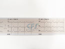 ECG Contec 90A NEW Cardiopocket - Elettrocardiografo a 3 canali + Software PC