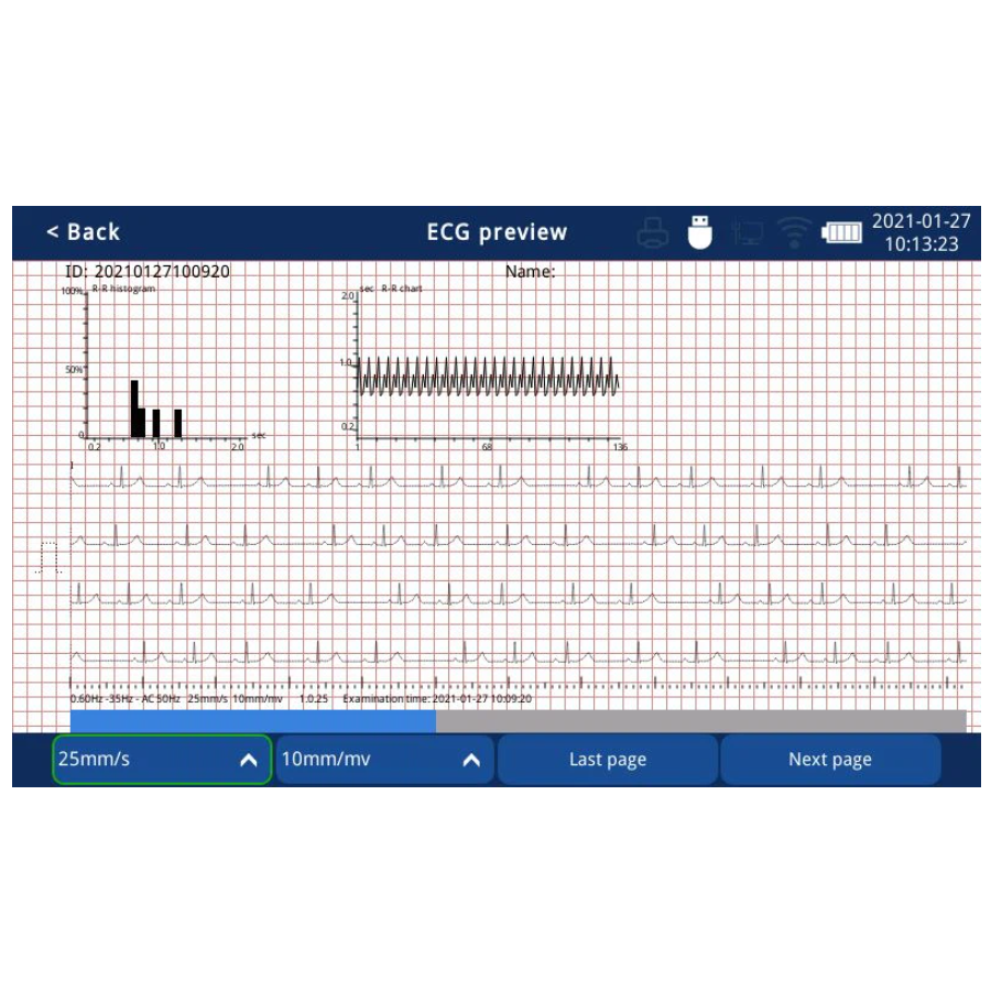 ECG Zoncare iMAC 300pro - Elettrocardiografo a 3 canali Interpretativo Glasgow
