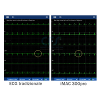 ECG Zoncare iMAC 300pro - Elettrocardiografo a 3 canali Interpretativo Glasgow