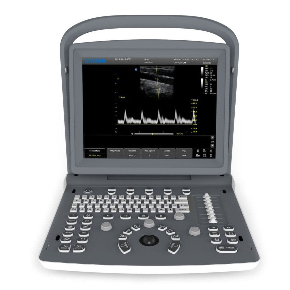 Ecografo Eco-Doppler portatile CHISON ECO2 - senza sonde