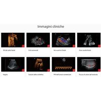 Ecografo Color-Doppler portatile MINDRAY Z50 - senza sonde