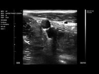 Ecografo Color-Doppler palmare ECOLESS EL-LNC21A1 con Sonda Lineare