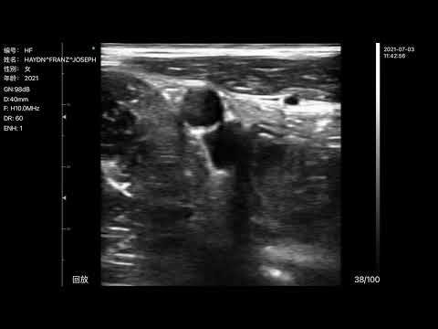 Ecografo Color-Doppler palmare ECOLESS EL-LNC21A1 con Sonda Lineare