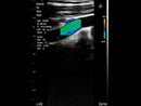 Ecografo Color-Doppler palmare ECOLESS EL-CL21A1 Sonda Convex/Lineare/Cardio