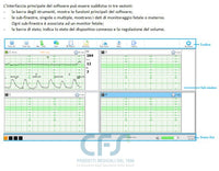 Software Smart OBS per monitor Smart FM