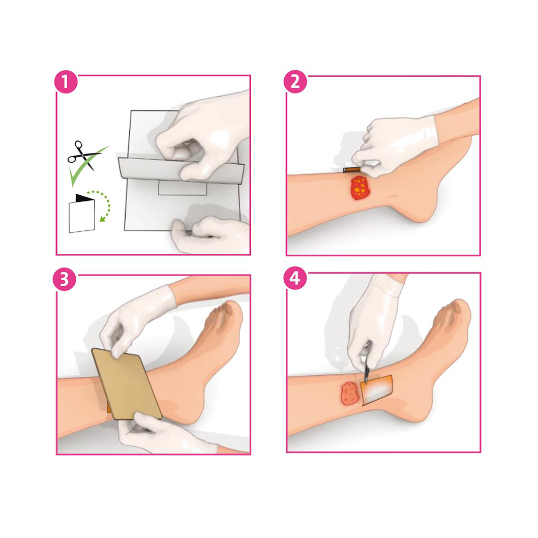 Inadine - Iodopovidone cm 5x5 (Conf. 25 pz.)