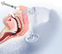 Atomizzatore nasale MAD100 con siringa 3 ml