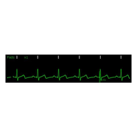 Monitor defibrillatore COMEN S5 a 5 derivazioni