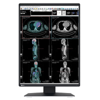 Monitor medicale da refertazione EIZO RX370 + RadiLight Omaggio!