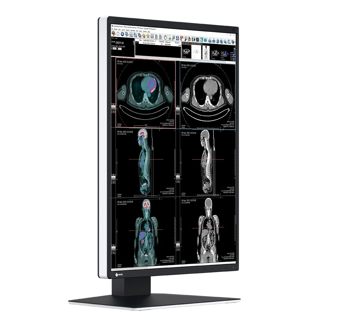 Monitor medicale da refertazione EIZO RX370 + RadiLight Omaggio!