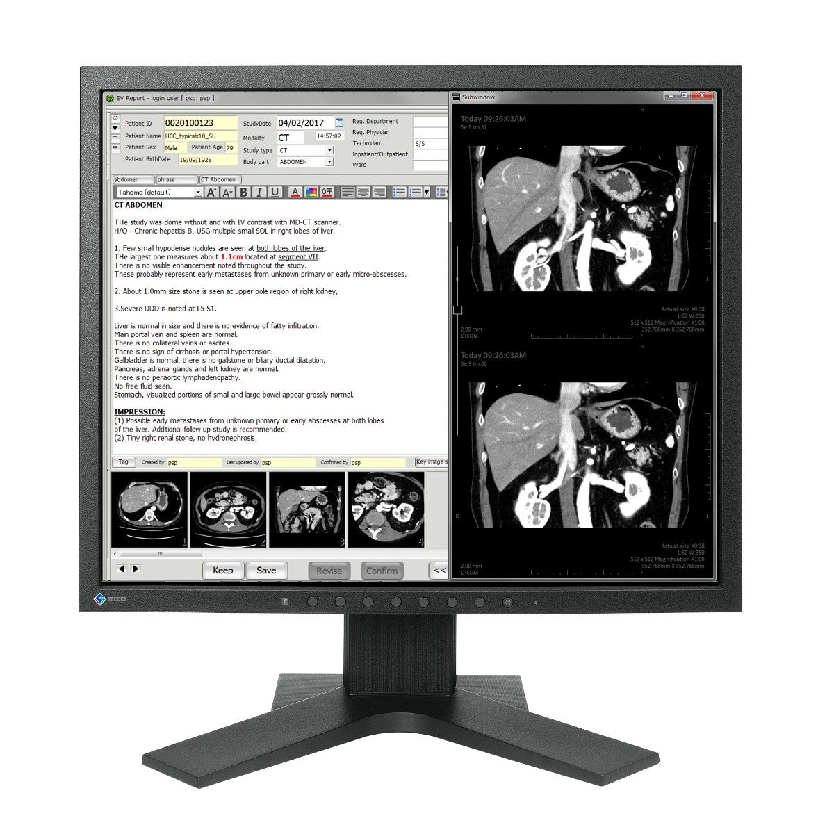 Monitor medicale da consultazione EIZO MX194 – CFS Prodotti Medicali