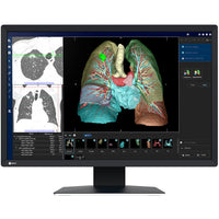 Monitor medicale da consultazione EIZO MX243W