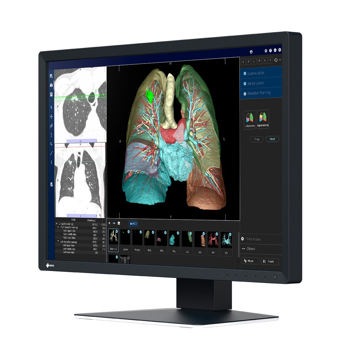 Monitor medicale da consultazione EIZO MX243W