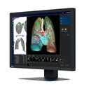 Monitor medicale da consultazione EIZO MX243W