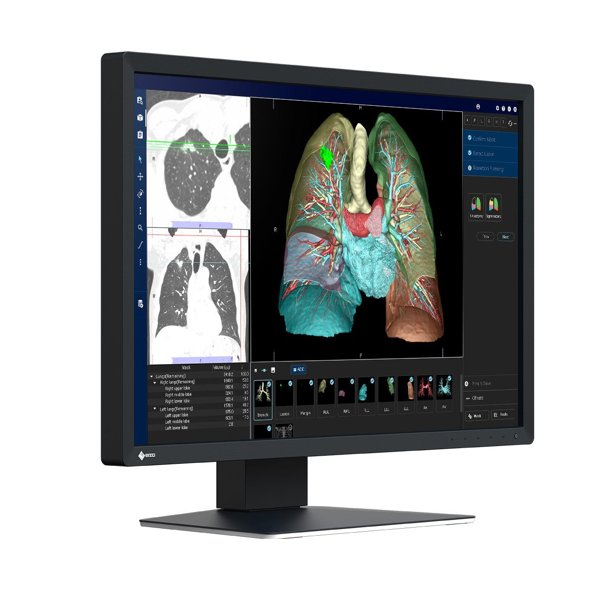 Monitor medicale da consultazione EIZO MX243W