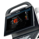 Color Doppler per Ecografo DP-50 EXPERT nuova versione