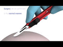 Bisturi di sicurezza monouso sterile Swann-Morton n.10 (conf. 25 pz.)
