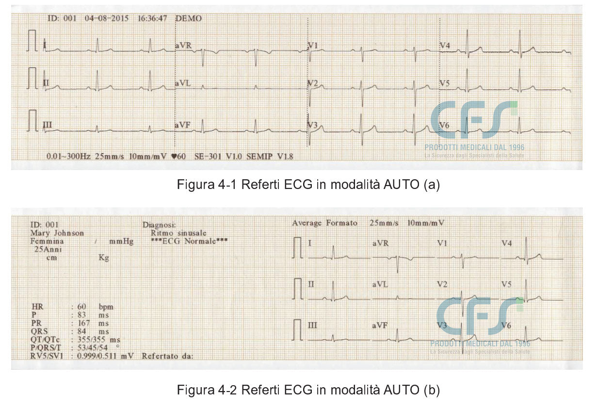 ECG Edan SE-301 Touch - Elettrocardiografo a 3-6 canali Interpretativo