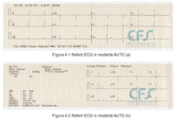 ECG Edan SE-301 Touch - Elettrocardiografo a 3-6 canali Interpretativo