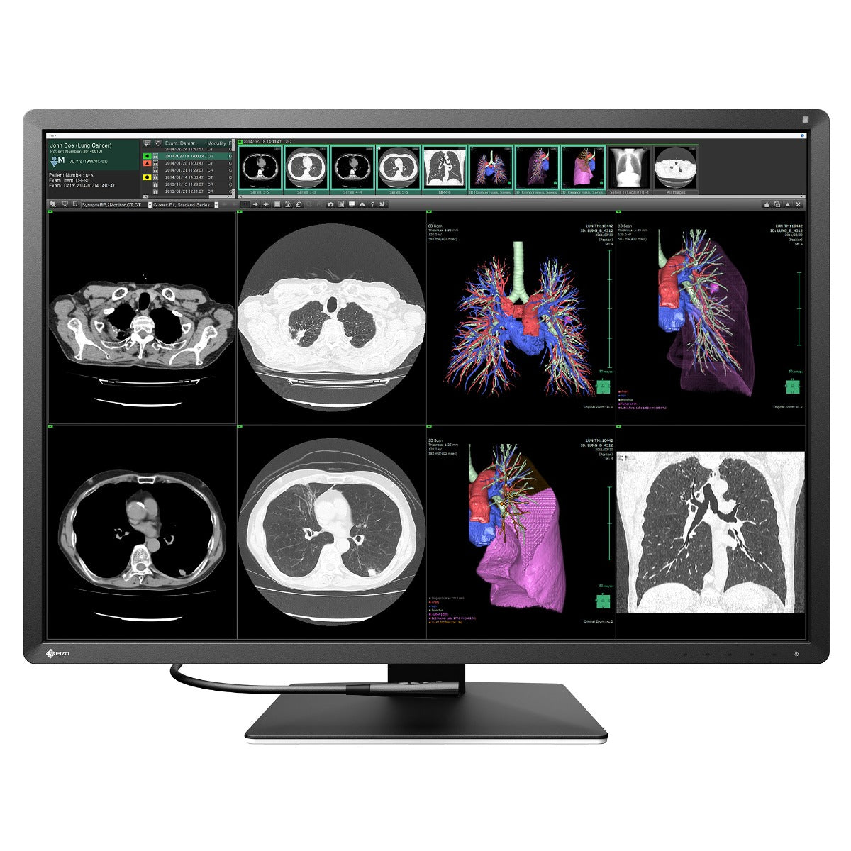 Escco Monitor Monitor medicale da refertazione EIZO RX1270 – CFS Prodotti Medicali s.r.l.