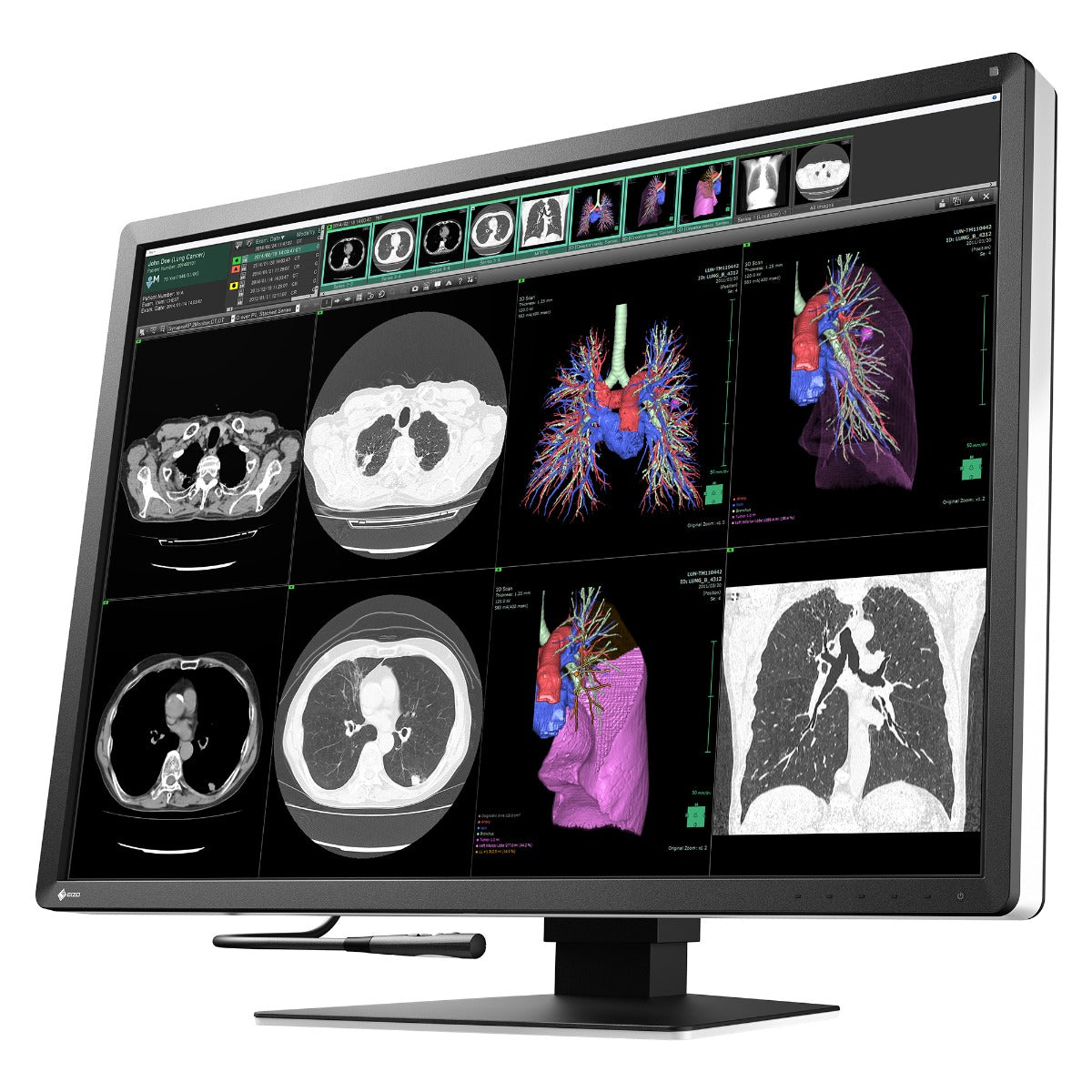 Monitor medicale da refertazione EIZO RX1270 + RadiLight Omaggio!