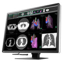 Monitor medicale da refertazione EIZO RX1270 + RadiLight Omaggio!