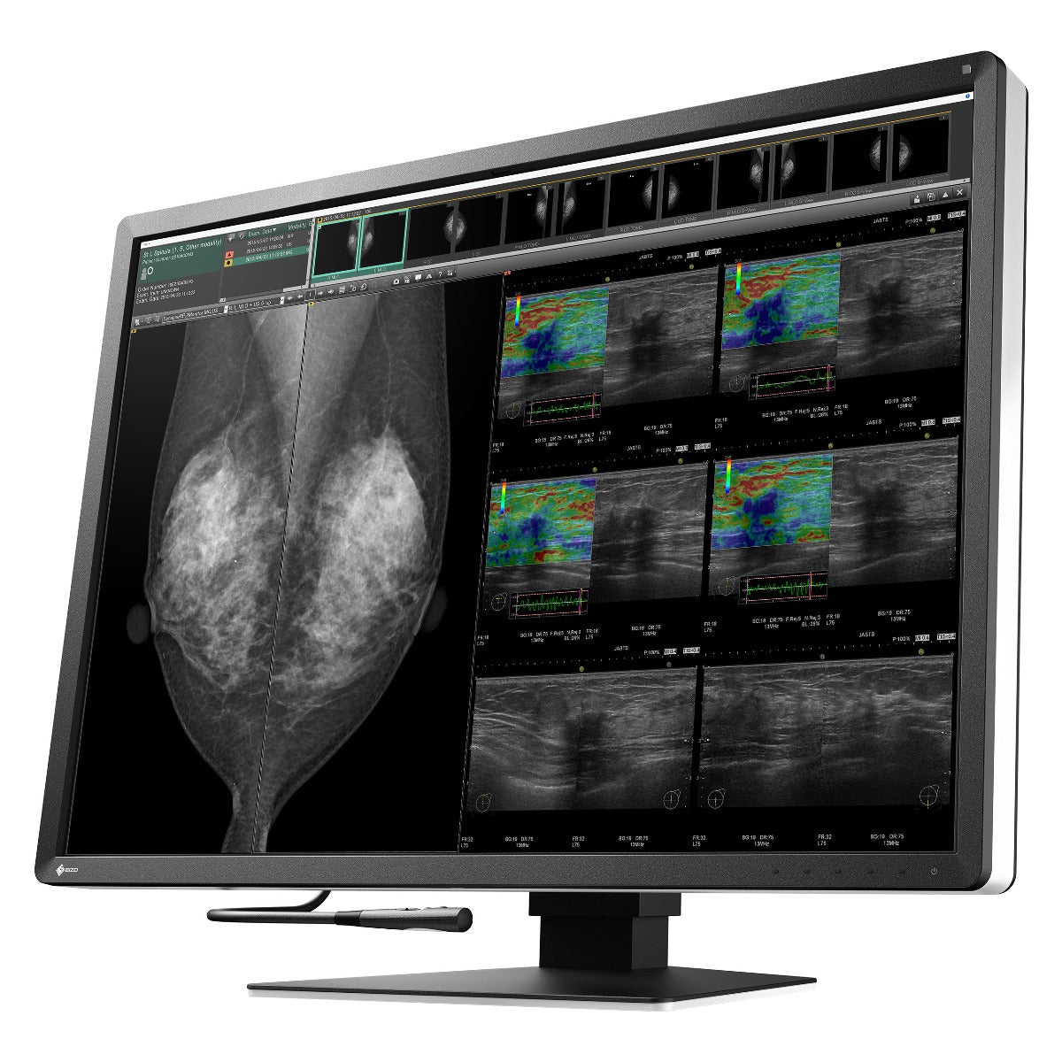 Monitor medicale da refertazione EIZO RX1270 + RadiLight Omaggio!