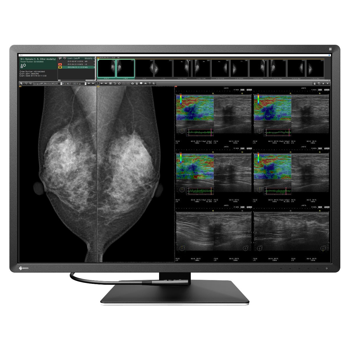 Monitor medicale da refertazione EIZO RX1270 + RadiLight Omaggio!