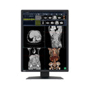 Monitor medicale da refertazione EIZO RX270 + RadiLight Omaggio!